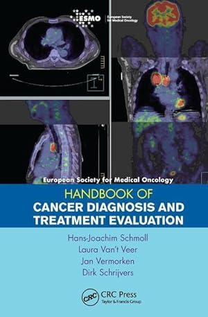 Bild des Verkufers fr ESMO Handbook of Cancer Diagnosis and Treatment Evaluation zum Verkauf von moluna
