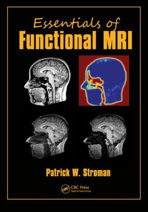 Bild des Verkufers fr Stroman, P: Essentials of Functional MRI zum Verkauf von moluna