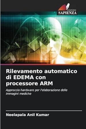 Seller image for Rilevamento automatico di EDEMA con processore ARM for sale by BuchWeltWeit Ludwig Meier e.K.