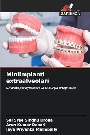 Bild des Verkufers fr Miniimpianti extraalveolari zum Verkauf von moluna