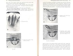 Bild des Verkufers fr Endodontic practice. [Dental diagnostic methods; Disease of the dental pulp; Diseases of the periapical tissues; Pulp capping; Pulpotomy; Pulp mummification; Pulpectomy; Rationale of endodontic treatment; Selection of cases for treatment; Principles of endodontic treatment; Anatomy of pulp cavity; Preparation of the root canal; Irrigation of the root canal; Sterilization of the root canal; Bacteriologic examination; Filling of the root canal; Root resection; Treatment of fractured and traumatized anterior teeth; Bleaching of discolored pulpless teeth; Endodontal-periodontal therapy] zum Verkauf von Joseph Valles - Books