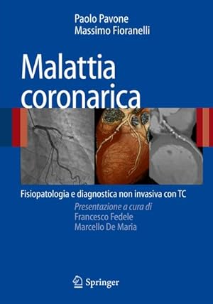 Bild des Verkufers fr Malattia Coronarica: Fisiopatologia E Diagnostica Non Invasiva Con Tc zum Verkauf von BuchWeltWeit Ludwig Meier e.K.