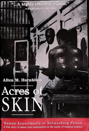 Bild des Verkufers fr Acres of skin. Human experiments at Holmesburg Prison : a story of abuse and exploitation in the name of medical science. zum Verkauf von Antiquariat Bookfarm