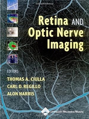 Seller image for Retina and Optic Nerve Imaging for sale by WeBuyBooks