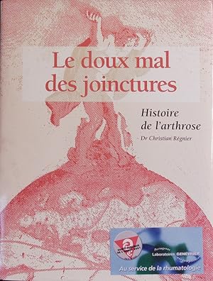 Bild des Verkufers fr Le doux mal des joinctures [sic]. Histoire de l'arthrose. zum Verkauf von Antiquariat Bookfarm