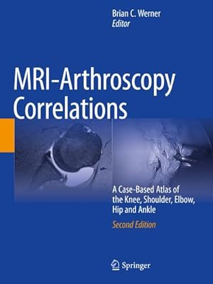 Immagine del venditore per MRI-Arthroscopy Correlations : A Case-Based Atlas of the Knee, Shoulder, Elbow, Hip and Ankle venduto da AHA-BUCH GmbH