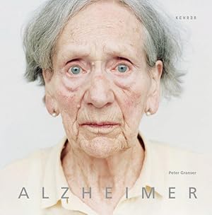 Seller image for Alzheimer for sale by Buchhandlung Loken-Books