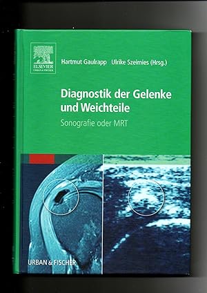 Bild des Verkufers fr Hartmut Gaulrapp, Ulrike Szeimies, Diagnostik der Gelenke und Weichteile : Sonografie oder MRT zum Verkauf von sonntago DE