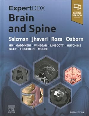 Seller image for ExpertDDX : Brain and Spine for sale by GreatBookPricesUK
