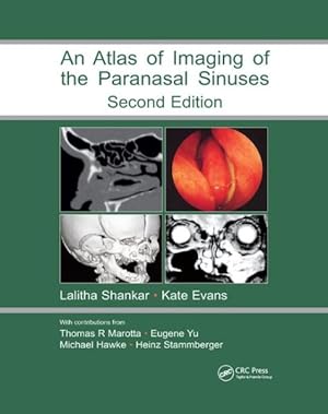 Seller image for Atlas of Imaging of the Paranasal Sinuses for sale by GreatBookPrices