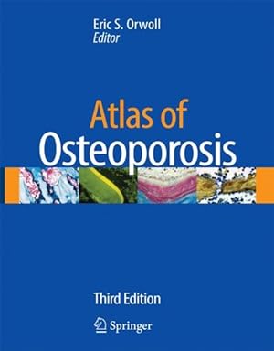 Seller image for Atlas of Osteoporosis for sale by GreatBookPrices
