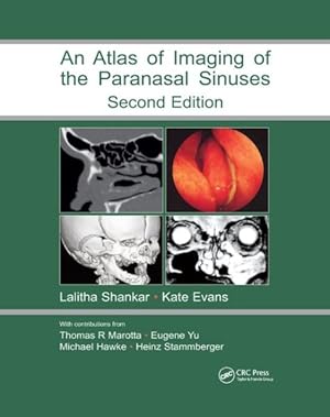 Seller image for Atlas of Imaging of the Paranasal Sinuses for sale by GreatBookPrices