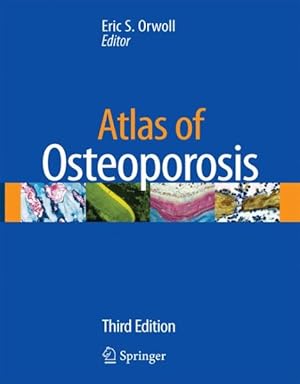 Seller image for Atlas of Osteoporosis for sale by GreatBookPrices