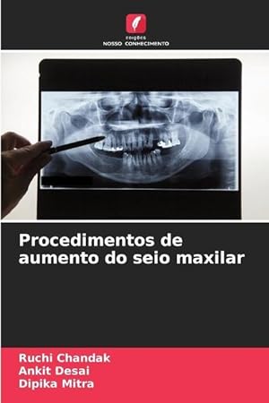 Imagen del vendedor de Procedimentos de aumento do seio maxilar a la venta por moluna