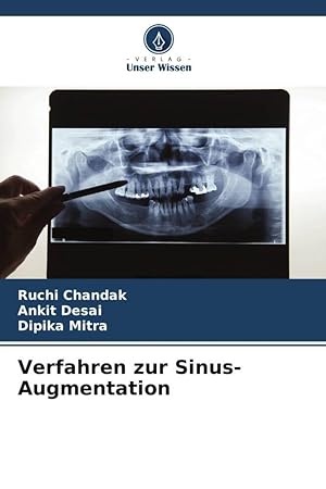 Imagen del vendedor de Verfahren zur Sinus-Augmentation a la venta por moluna