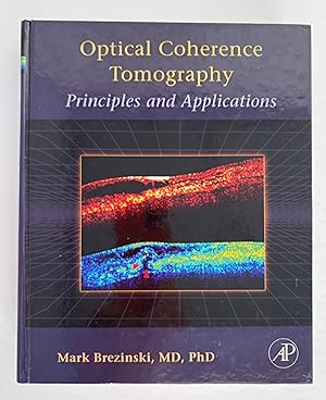 Optical Coherence Tomography: Principles and Applications