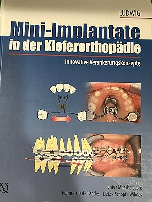 Seller image for Mini-implants in Orthodontic: Innovative Anchorage Concepts (In German Language) for sale by Front Range Books, LLC