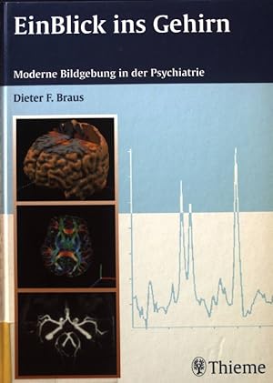 Bild des Verkufers fr Ein Blick ins Gehirn. Bildgebung in der modernen Psychiatrie. zum Verkauf von books4less (Versandantiquariat Petra Gros GmbH & Co. KG)