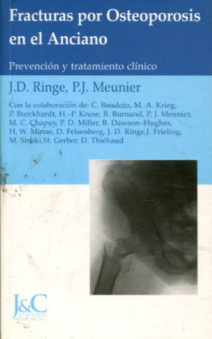 Seller image for FRACTURAS POR OSTEOPOROSIS EN EL ANCIANO. PREVENCION Y TRATAMIENTO CLINICO. for sale by Libros Ambig