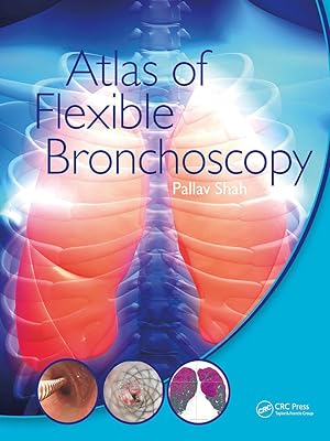 Seller image for Atlas of Flexible Bronchoscopy for sale by moluna