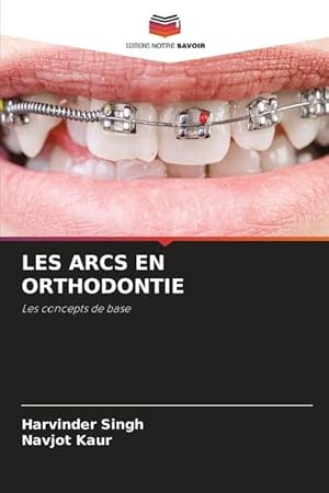 Seller image for LES ARCS EN ORTHODONTIE for sale by moluna