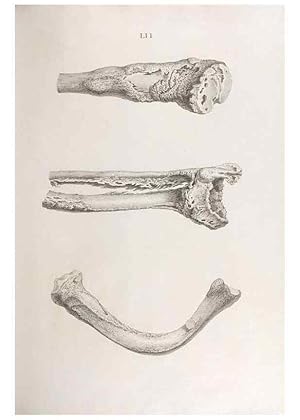 Bild des Verkufers fr Reproduccin/Reproduction 48833001652: Osteographia, or the Anatomy of the Bones. London,1733. zum Verkauf von EL BOLETIN