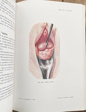 Bild des Verkufers fr Lehrbuch der Gynakologie. 5., neubearb. Auflage. Mit 465 schwarzen u. farbigen Abbildungen im Text und auf 66 farbigen Tafeln. zum Verkauf von Treptower Buecherkabinett Inh. Schultz Volha