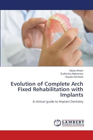 Seller image for Evolution of Complete Arch Fixed Rehabilitation with Implants for sale by moluna