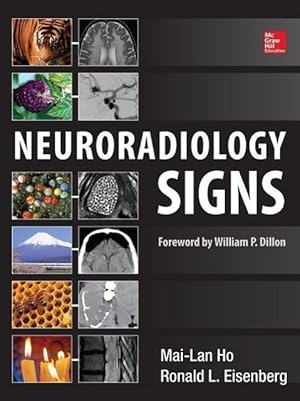 Imagen del vendedor de Neuroradiology Signs a la venta por moluna