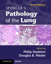 Seller image for Spencer s Pathology of the Lung 2 Part Set for sale by moluna