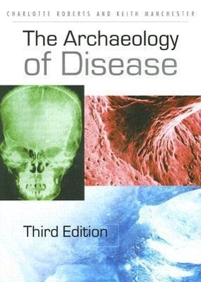 Bild des Verkufers fr The Archaeology of Disease zum Verkauf von moluna