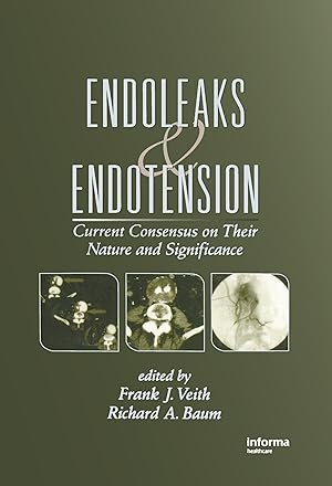Seller image for Endoleaks and Endotension for sale by moluna
