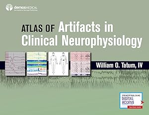 Bild des Verkufers fr Atlas of Artifacts in Clinical Neurophysiology zum Verkauf von moluna