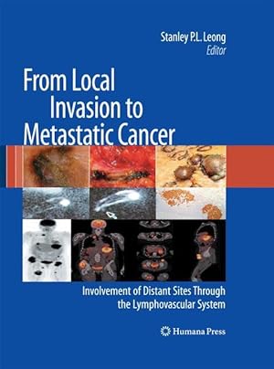 Seller image for From Local Invasion to Metastatic Cancer for sale by moluna