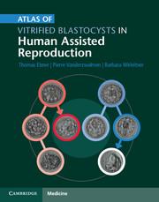 Seller image for Atlas of Vitrified Blastocysts in Human Assisted Reproduction for sale by moluna
