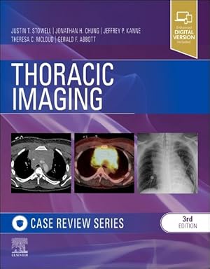 Image du vendeur pour Thoracic Imaging : Case Review mis en vente par GreatBookPrices