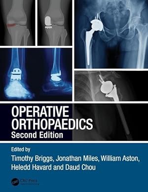 Seller image for Operative Orthopaedics for sale by moluna