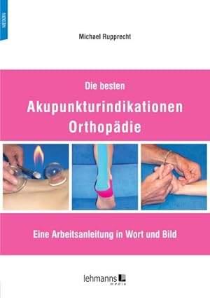 Bild des Verkufers fr Die besten Akupunkturindikationen Orthopdie : Eine Arbeitsanleitung in Wort und Bild zum Verkauf von AHA-BUCH GmbH