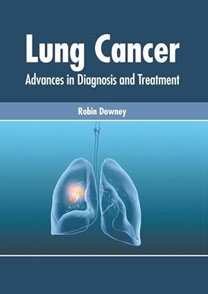 Seller image for Lung Cancer: Advances in Diagnosis and Treatment for sale by moluna