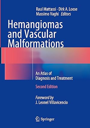 Seller image for Hemangiomas and Vascular Malformations for sale by moluna