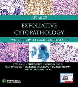 Bild des Verkufers fr Atlas of Exfoliative Cytopathology: With Histopathologic Correlations zum Verkauf von moluna