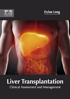 Seller image for Liver Transplantation: Clinical Assessment and Management for sale by moluna