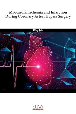 Seller image for Myocardial Ischemia and Infarction During Coronary Artery Bypass Surgery for sale by moluna