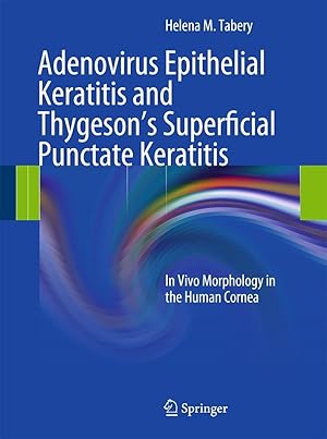 Bild des Verkufers fr Adenovirus Epithelial Keratitis and Thygeson s Superficial Punctate Keratitis zum Verkauf von moluna