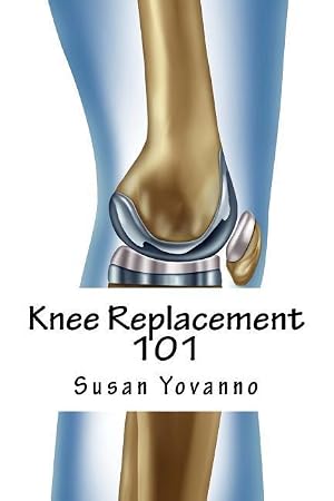 Immagine del venditore per Knee Replacement 101: A User\ s Guide to Preparation for and Recovery After Knee Arthroplasty venduto da moluna
