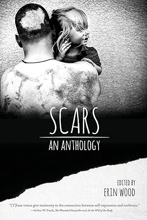 Seller image for Scars: An Anthology for sale by moluna