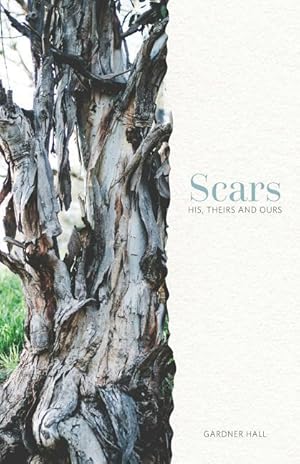 Bild des Verkufers fr Scars: His, Theirs and Ours zum Verkauf von moluna