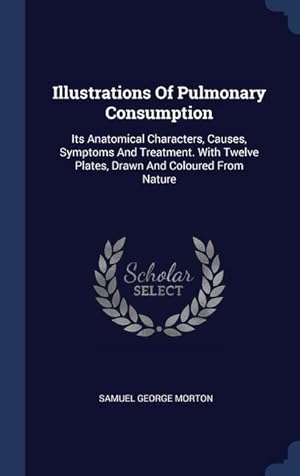 Bild des Verkufers fr Illustrations Of Pulmonary Consumption: Its Anatomical Characters, Causes, Symptoms And Treatment. With Twelve Plates, Drawn And Coloured From Nature zum Verkauf von moluna