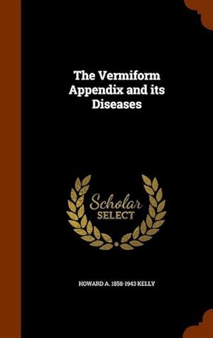 Bild des Verkufers fr The Vermiform Appendix and its Diseases zum Verkauf von moluna