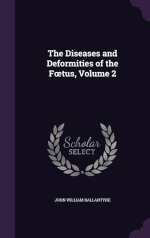 Bild des Verkufers fr The Diseases and Deformities of the Foetus, Volume 2 zum Verkauf von moluna